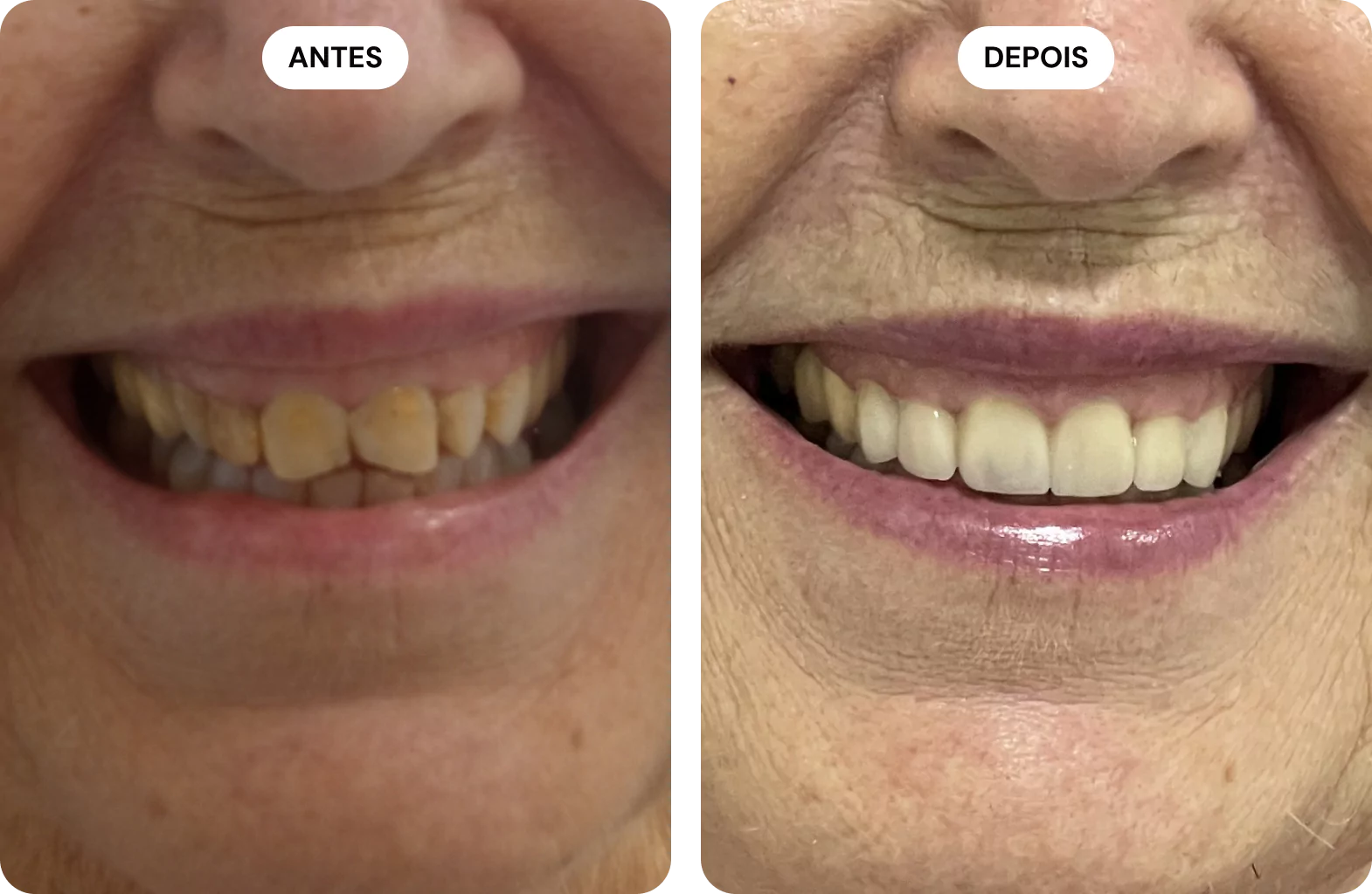 group-1000004377-686fd3ed8e298